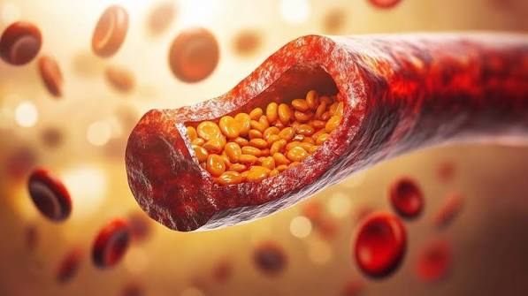 Cholesterol Support